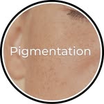 Pigmentation